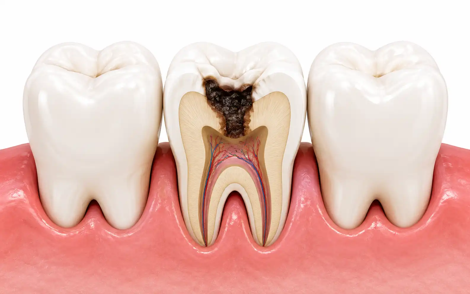 Close view of restorative dental care